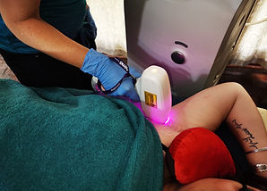 laser hair removal 2.jpg