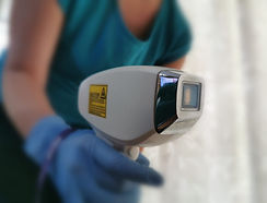 laser hair removal